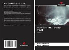 Tumors of the cranial vault的封面