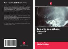 Couverture de Tumores da abóbada craniana