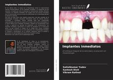 Portada del libro de Implantes inmediatos