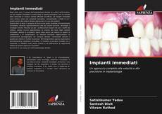 Buchcover von Impianti immediati