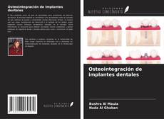 Portada del libro de Osteointegración de implantes dentales