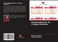 Copertina di Osséointégration de l'implant dentaire