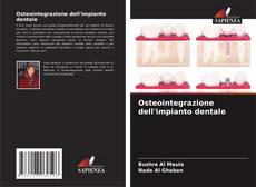 Couverture de Osteointegrazione dell'impianto dentale