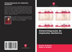 Couverture de Osteointegração de implantes dentários