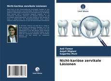 Nicht-kariöse zervikale Läsionen kitap kapağı