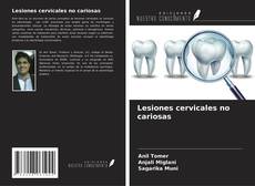 Couverture de Lesiones cervicales no cariosas