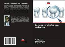 Capa do livro de Lésions cervicales non carieuses 