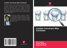 Couverture de Lesões Cervicais Não Cariosas