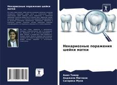 Некариозные поражения шейки матки的封面