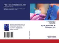 Couverture de Open Apex and its Management