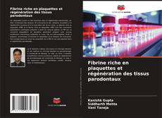 Bookcover of Fibrine riche en plaquettes et régénération des tissus parodontaux