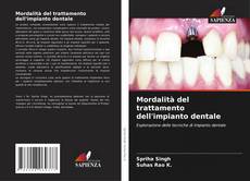 Bookcover of Mordalità del trattamento dell'impianto dentale