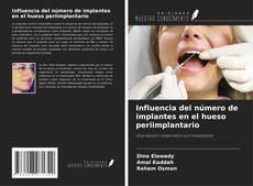 Portada del libro de Influencia del número de implantes en el hueso periimplantario