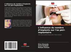 Bookcover of L'influence du nombre d'implants sur l'os péri-implantaire