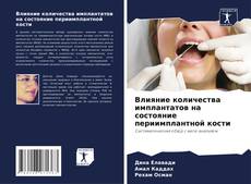 Borítókép a  Влияние количества имплантатов на состояние периимплантной кости - hoz