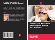 Couverture de A influência do número de implantes no osso peri-implantar