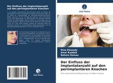 Der Einfluss der Implantatanzahl auf den periimplantären Knochen的封面