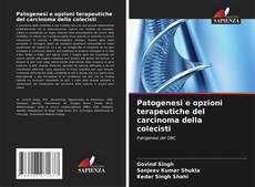 Bookcover of Patogenesi e opzioni terapeutiche del carcinoma della colecisti