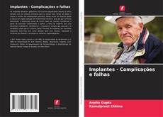 Couverture de Implantes - Complicações e falhas