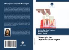 Copertina di Chirurgische Implantatführungen