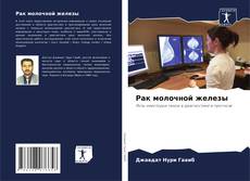 Bookcover of Рак молочной железы