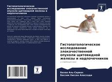 Borítókép a  Гистопатологическое исследование злокачественной опухоли щитовидной железы и надпочечников - hoz