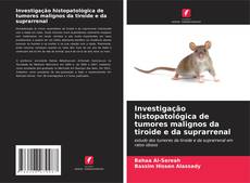 Couverture de Investigação histopatológica de tumores malignos da tiroide e da suprarrenal