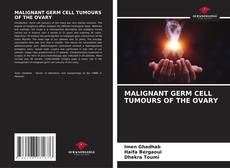 Обложка MALIGNANT GERM CELL TUMOURS OF THE OVARY