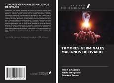 Couverture de TUMORES GERMINALES MALIGNOS DE OVARIO