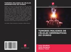 Couverture de TUMORES MALIGNOS DE CÉLULAS GERMINATIVAS DO OVÁRIO