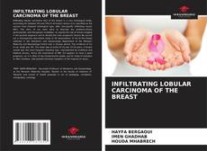 Buchcover von INFILTRATING LOBULAR CARCINOMA OF THE BREAST