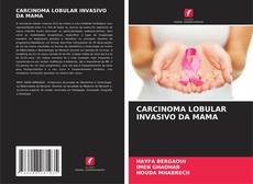 Couverture de CARCINOMA LOBULAR INVASIVO DA MAMA