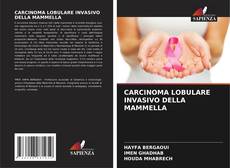 Bookcover of CARCINOMA LOBULARE INVASIVO DELLA MAMMELLA