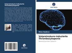 Copertina di Valproinsäure-induzierte Thrombozytopenie