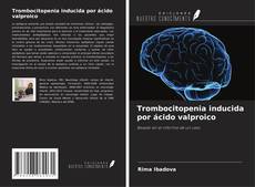 Portada del libro de Trombocitopenia inducida por ácido valproico