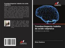 Bookcover of Trombocitopenia indotta da acido valproico