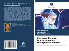 Copertina di Koronare Bypass-Operationen am schlagenden Herzen