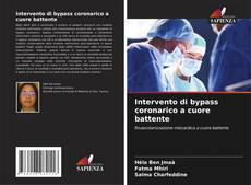 Bookcover of Intervento di bypass coronarico a cuore battente