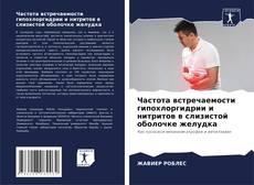 Borítókép a  Частота встречаемости гипохлоргидрии и нитритов в слизистой оболочке желудка - hoz