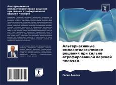 Borítókép a  Альтернативные имплантологические решения при сильно атрофированной верхней челюсти - hoz