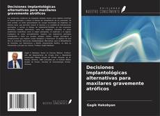 Обложка Decisiones implantológicas alternativas para maxilares gravemente atróficos