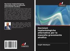 Bookcover of Decisioni implantologiche alternative per la mascella gravemente atrofica