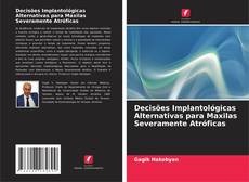 Buchcover von Decisões Implantológicas Alternativas para Maxilas Severamente Atróficas