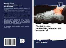 Portada del libro de Изображение микрокристаллических артропатий