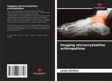 Buchcover von Imaging microcrystalline arthropathies