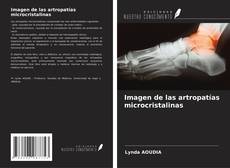 Portada del libro de Imagen de las artropatías microcristalinas