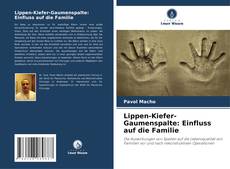 Copertina di Lippen-Kiefer-Gaumenspalte: Einfluss auf die Familie