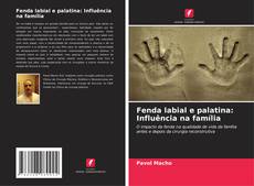 Couverture de Fenda labial e palatina: Influência na família