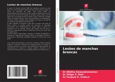 Portada del libro de Lesões de manchas brancas