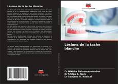 Обложка Lésions de la tache blanche